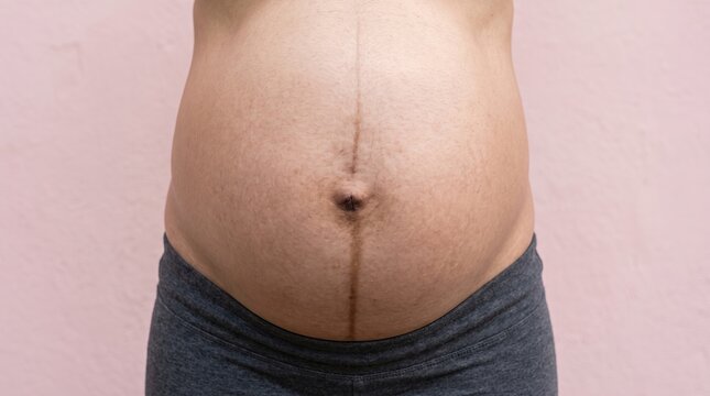 Front view of pregnant woman belly showing vertical hyperpigmented linea nigra