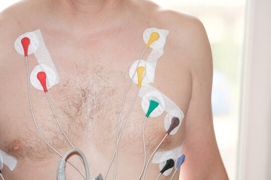 Holter monitor electrodes are placed on a male chest, featuring adhesive pads and wires, illuminated by natural light in a clinical environment