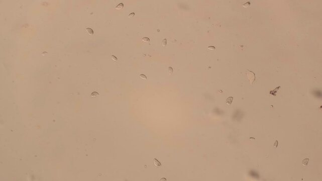Motile Protozoa Cells Swimming Under Light Microscope