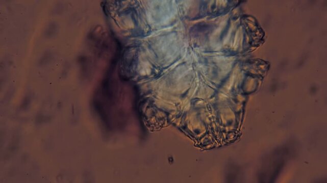 Demodex Mite Elongated Body Segments Microscopic View Human Skin