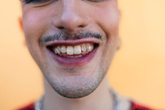 Person smiling showing teeth with tooth gems