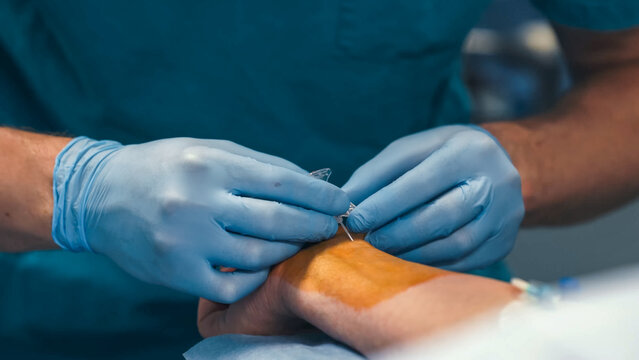 Close-up of a healthcare worker inserting a peripheral IV cannula into a vein in a patient's hand. Concept vascular access and medical care.