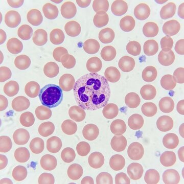 Light Micrograph of Human Peripheral Blood Smear Highlighting Leukocyte Diversity and Immune Response Concept