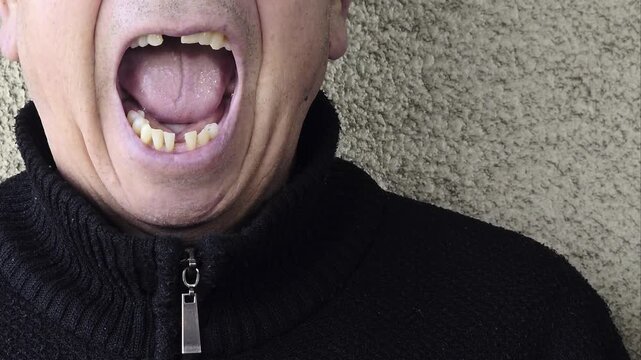 Close up of yellow stained teeth and tooth loss, illustrating poor dental health, oral hygiene problems and long term consequences of smoking and tobacco use (toothless or edentulous)
