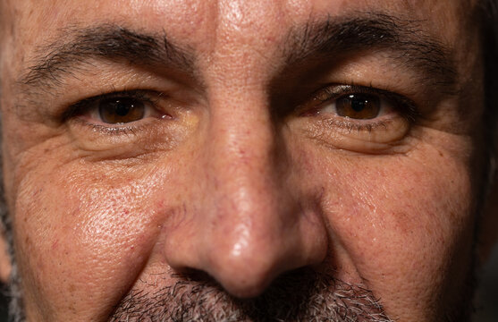 Middle-aged male showing coarse stubble and pronounced skin pores in studio close-up lighting