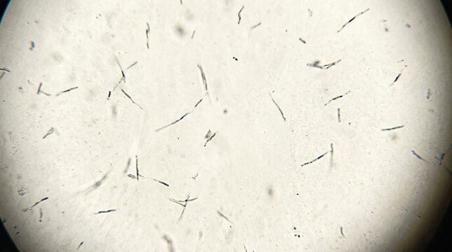Microscopic view of rod shaped bacteria cells floating in a liquid sample under a laboratory microscope