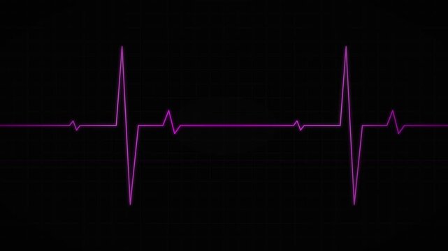 fuchsia pink digital pulse vector animation overlay effect