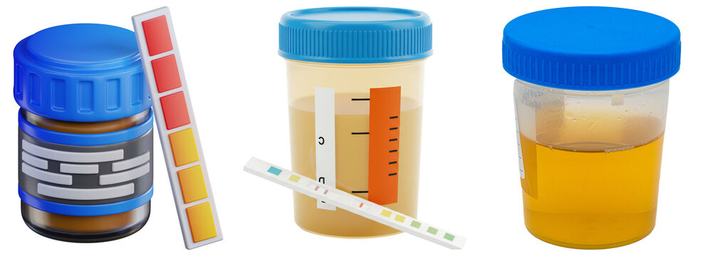 Three urine sample cups with blue lids and urine test strips, isolated on white background.