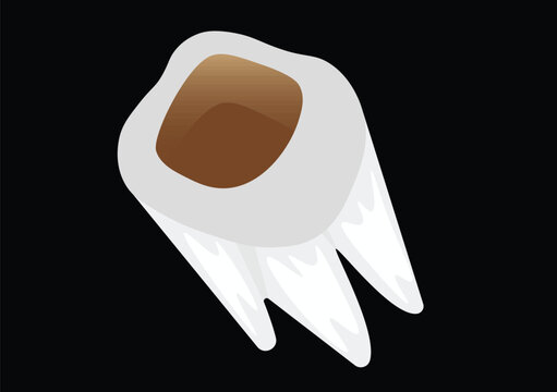 White Tooth with Large Brown Cavity
