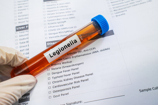 blood sample in lab test tube for Legionella test