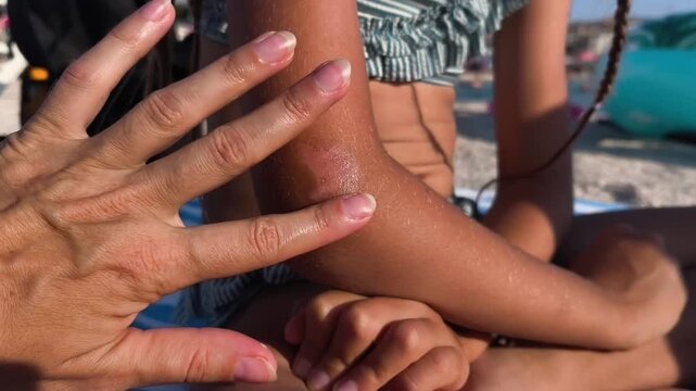 Adult applying sunscreen lotion to a child's arm outdoors on a sunny beach.