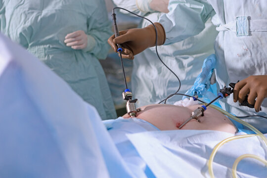 Surgeon hands in brown gloves hold laparoscopic instruments during surgery. Trocars inserted into patient body. Medical monitors and equipment in background. Minimally invasive procedure