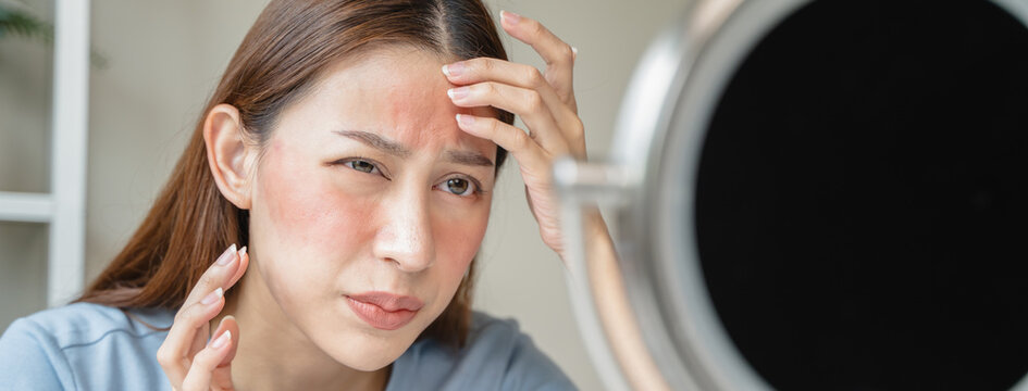 Sensitive skin with cosmetology, Asian young woman looking at red spot on her face from cosmetic allergy in the mirror.