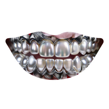 Close up of human teeth with silver metallic grillz isolated on white background