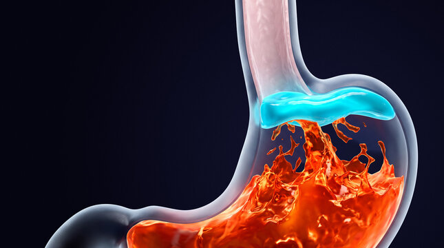 3D illustration of stomach acid reflux with a blue protective antacid layer