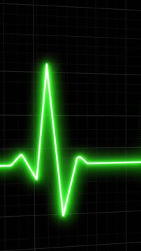 Animation of heartbeats displayed showing changes over time