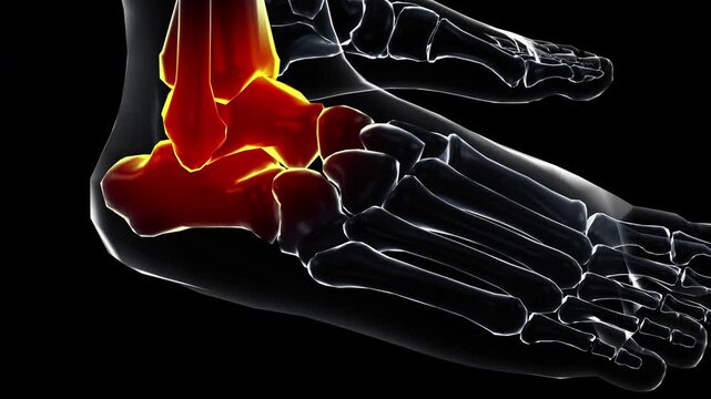 Medical dynamic video materials on bone and joint diseases