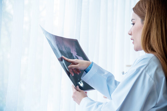 Two women doctors consulting diagnostics using x-ray film at hospital medicare treatment clinic. Healthcare concept. Doctor writing prescription for medical healthcare oncologist therapy using laptop