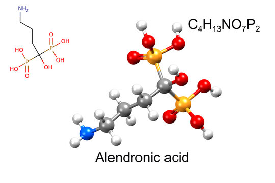 Structure of alendronic acid, a medicine for osteoporosis. Chemical formula, structural formula, and 3D ball-and-stick model.