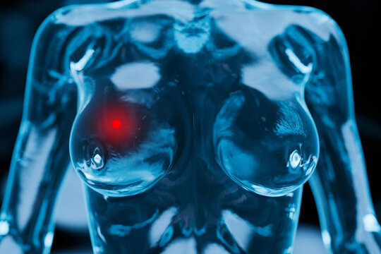 Clear glass anatomical female model, showing a red glowing point as a localized tumor in one breast, symbolizing early breast cancer detection and awareness.