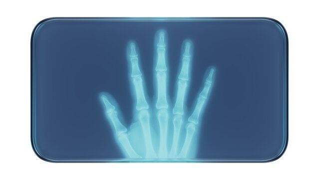 Glass Frame with X-Ray Human Fingers Medical Illustration