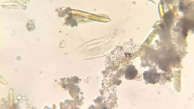 Boat Shaped Diatom Cells Swimming in Pond Water Microscopic View