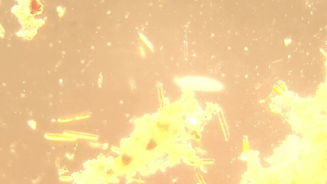 Chain Forming Diatom Colony Drifting in Freshwater Pond Water Video