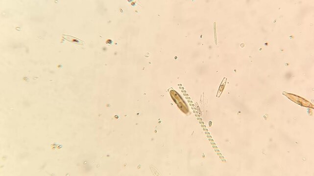 Live Pennate Diatoms Gliding in Freshwater Pond Water Under Microscope