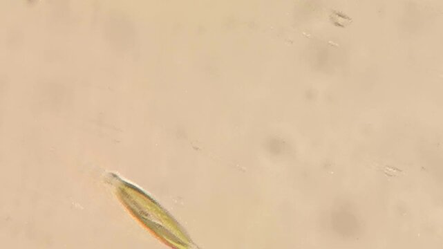 Needle Shaped Diatoms Floating among Organic Particles in Pond Water