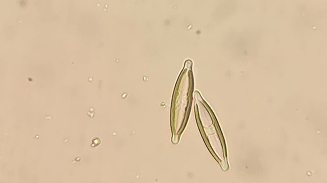 Silica Shelled Pennate Diatoms Moving in Freshwater Under Light Microscope