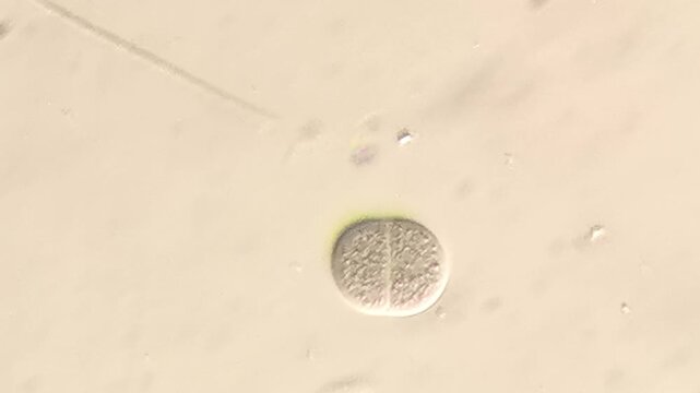 Colonial Chain Diatoms Clustered in Freshwater Pond Water Microscope View