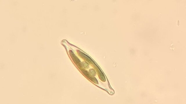 Silica Shelled Pennate Diatoms Moving in Freshwater Under Light Microscope