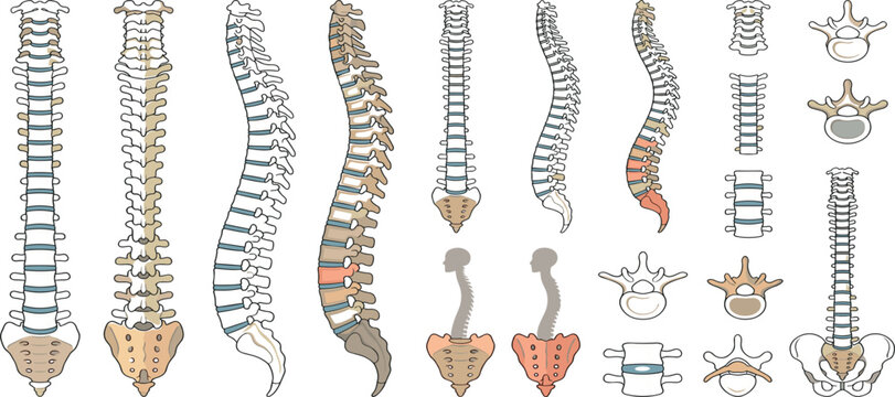 Human vertebral column anatomy set with scoliosis posture diagrams vector for orthopedic medical design