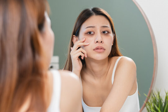 lack of sleep problem, Worried Asian young woman pointing finger at dark circles under her eyes