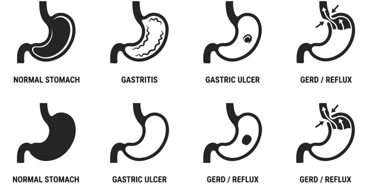 Stomach health conditions and digestive disorders icons set