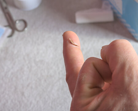 Close-up of an injured finger with a small cut and home first aid kit in the background. Concept of wound care and domestic treatment