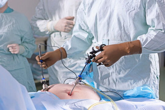 Surgeon hands in brown gloves hold laparoscopic instruments during surgery. Trocars inserted into patient body. Surgeon holds laparoscopic instruments in operating room