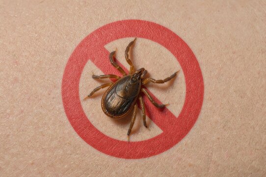 Tick bite prevention, prohibition symbol on human skin represents protection against ticks, parasites, infection and vector-borne diseases.