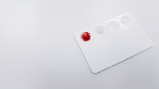 Blood typing test card with red drop sample on white surface for medical screening