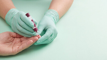 Fototapeta premium blood donation medical professional using lancet device for finger prick test in clinic