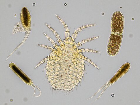 Microscopic view shows mite arthropod with segmented legs, surrounded by various microorganisms like amoeba and bacteria in sample. Tiny creatures, scientific research, life forms.