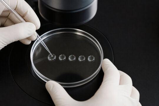 Embryo washing procedure in culture dish microdrops
