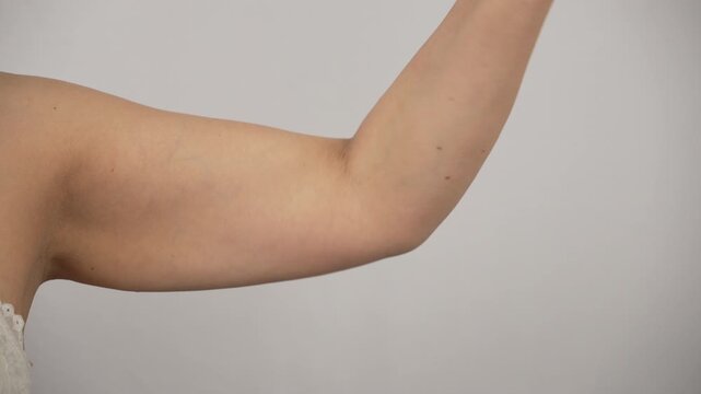 Female Upper Arm Close Up Flexing to Show Loose Skin and Flab