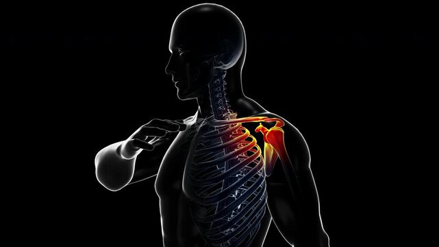Medical dynamic video materials on bone and joint diseases