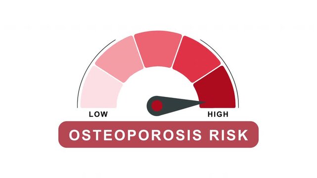 Osteoporosis Risk Level Gauge Animation from Low to High Indicator on Bone Health and Medical Healthcare Background Motion Graphics