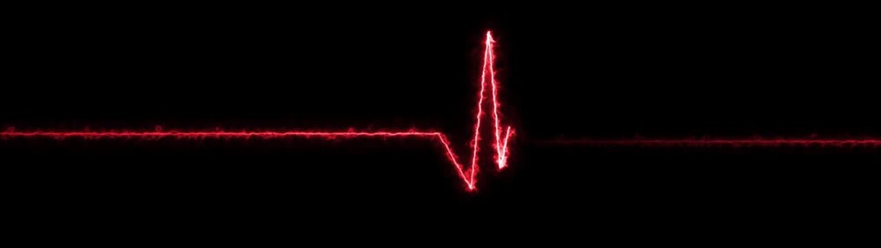 ECG monitor beating heart with a neon electrocardiogram overlay, featuring dynamic HUD elements and a gradient background