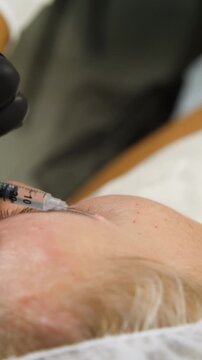 Professional cosmetologist making botox injection in female forehead close up. Doctor giving mesotherapy injections to patient face in beauty clinic - Vertical Video