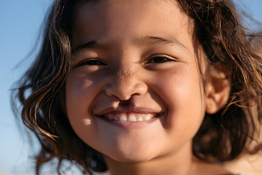 Children with a cleft lip smiling confidently in natural sunlight
