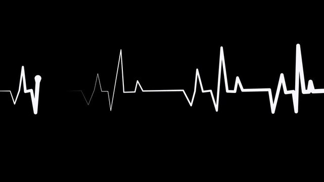 Heartbeat line showing an electrocardiogram trace medical background with sharp spikes and a flat rhythm animation