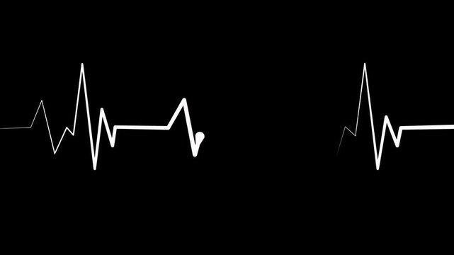 Heartbeat line showing an irregular electrocardiogram style signal, medical concept for health animation
